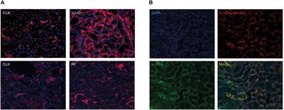 Long Non-coding RNAs Rian and Miat Mediate Myofibroblast Formation in Kidney Fibrosis